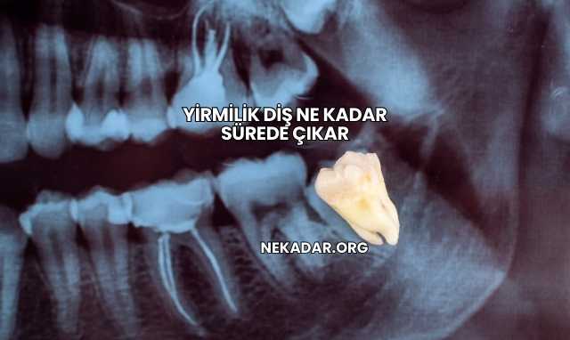 Yirmilik Diş Ne Kadar Sürede Çıkar